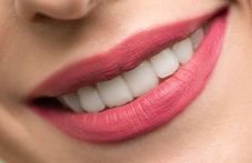 Healthy smiling mouth